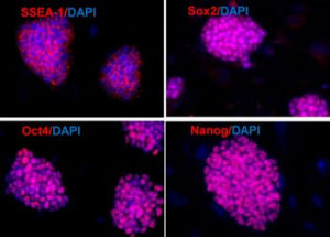Obtención de células madre con proteínas